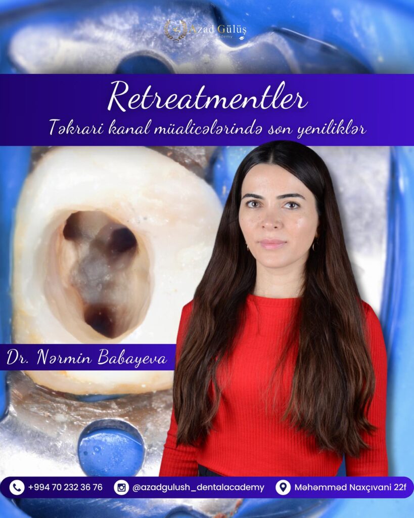 " Retreatmentlər" Təkrar kanal müalicəsində yeniliklər